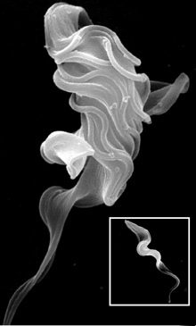 Ablation of flagellar proteins in African sleeping sickness parasite; monstrous cells arise (main pic) & rapidly die as parasites fail to divide - Inset: normal trypanosome for comparison not to scale